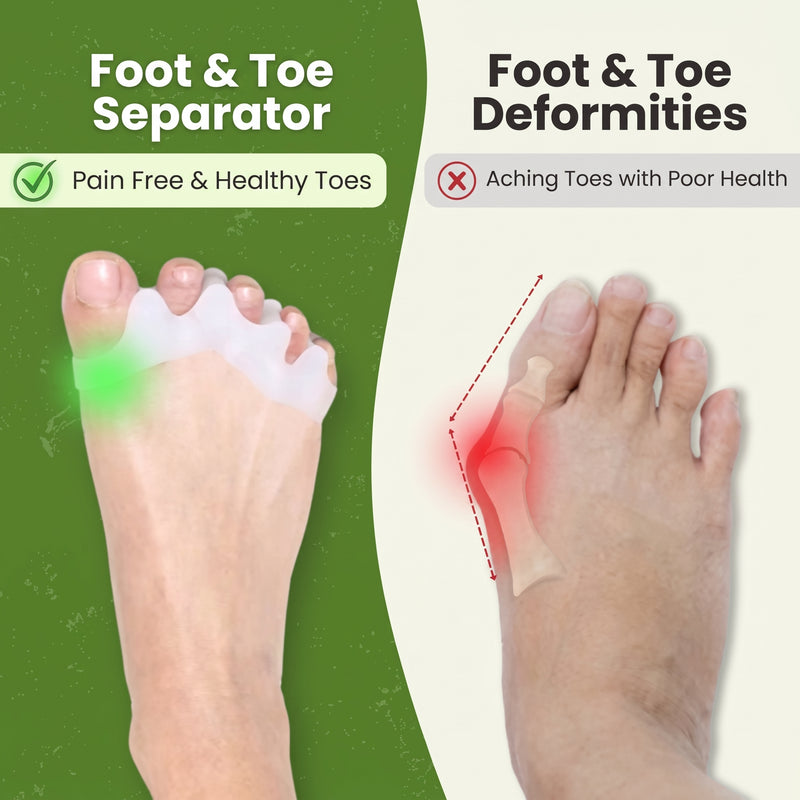 Unisex Gel Toe Separators for Foot Pain Relief and Alignment